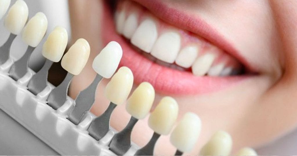 Up to 8 Shade Brighter Teeth - Shades Scale